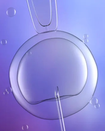 Laser-Assisted Hatching